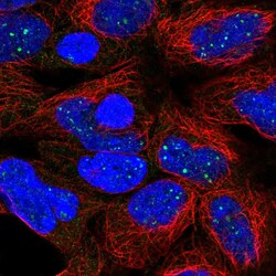 Invitrogen DISP1 Polyclonal Antibody 100 &mu;L; Unconjugated:Antibodies,