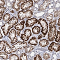 Invitrogen DISP1 Polyclonal Antibody 100 &mu;L; Unconjugated:Antibodies,