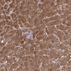 Invitrogen Diazepam Binding Inhibitor Polyclonal Antibody 100 &mu;L; Unconjugated:Antibodies,