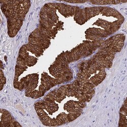 Invitrogen Diazepam Binding Inhibitor Polyclonal Antibody 100 &mu;L; Unconjugated:Antibodies,