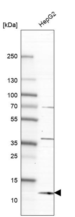 Invitrogen Diazepam Binding Inhibitor Polyclonal Antibody 100 &mu;L; Unconjugated:Antibodies,