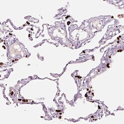Invitrogen LAMP3 Polyclonal Antibody 100 &mu;L; Unconjugated:Antibodies,