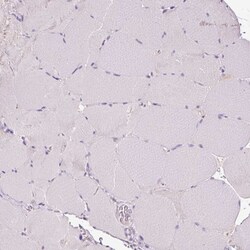 Invitrogen LAMP3 Polyclonal Antibody 100 &mu;L; Unconjugated:Antibodies,