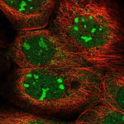 Invitrogen KRR1 Polyclonal Antibody 100 &mu;L; Unconjugated:Antibodies,