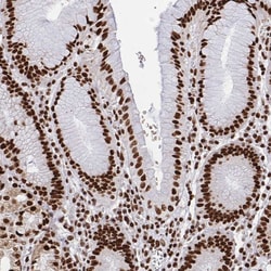 Invitrogen hnRNP L Polyclonal Antibody 100 &mu;L; Unconjugated:Antibodies,