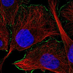 Invitrogen CaMKII alpha Polyclonal Antibody 100 &mu;L; Unconjugated:Antibodies,