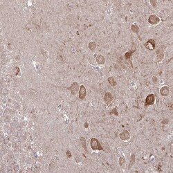 Invitrogen CaMKII alpha Polyclonal Antibody 100 &mu;L; Unconjugated:Antibodies,