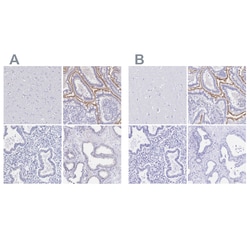 Invitrogen SGLT1 Polyclonal Antibody 100 &mu;L | Buy Online | Invitrogen&trade; | Fisher Scientific