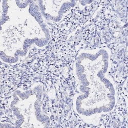 Invitrogen SGLT1 Polyclonal Antibody 100 &mu;L | Buy Online | Invitrogen&trade; | Fisher Scientific