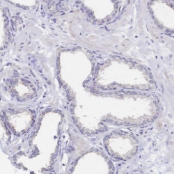 Invitrogen SGLT1 Polyclonal Antibody 100 &mu;L | Buy Online | Invitrogen&trade; | Fisher Scientific