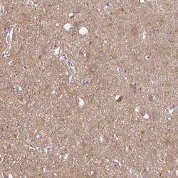 Invitrogen Talin 2 Polyclonal Antibody 100 &mu;L; Unconjugated:Anticorps,