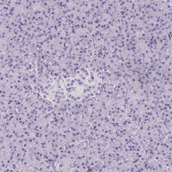 Invitrogen Talin 2 Polyclonal Antibody 100 &mu;L; Unconjugated:Anticorps,