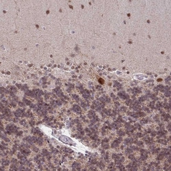 Invitrogen BRD3 Polyclonal Antibody 100 &mu;L; Unconjugated:Antibodies,