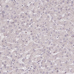 Invitrogen BRD3 Polyclonal Antibody 100 &mu;L; Unconjugated:Antibodies,