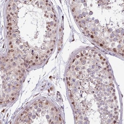 Invitrogen BRD3 Polyclonal Antibody 100 &mu;L; Unconjugated:Antibodies,