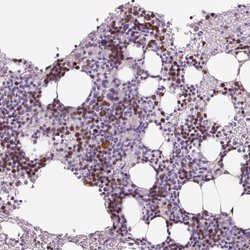 EKLF Rabbit anti-Human, Polyclonal, Invitrogen 100 &mu;L; Unconjugated:Antibodies,