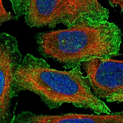 Invitrogen MYL4 Polyclonal Antibody 100 &mu;L; Unconjugated:Antibodies,