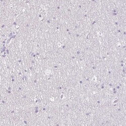 Invitrogen MYL4 Polyclonal Antibody 100 &mu;L; Unconjugated:Antibodies,