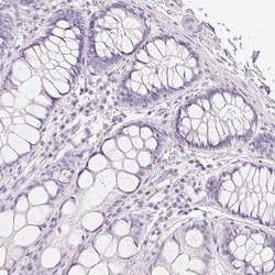 Invitrogen MYL4 Polyclonal Antibody 100 &mu;L; Unconjugated:Antibodies,