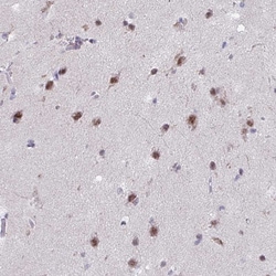 Invitrogen PUF60 Polyclonal Antibody 100 &mu;L; Unconjugated:Antibodies,