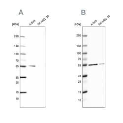 Invitrogen GPI Polyclonal Antibody 100 &mu;L; Unconjugated:Antibodies,