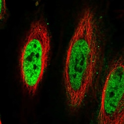 Invitrogen TDG Polyclonal Antibody 100 &mu;L; Unconjugated:Antibodies,