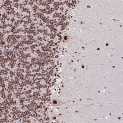 Invitrogen TDG Polyclonal Antibody 100 &mu;L; Unconjugated:Antibodies,