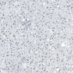 Invitrogen SUV420H2 Polyclonal Antibody 100 &mu;L | Buy Online | Invitrogen&trade; | Fisher Scientific