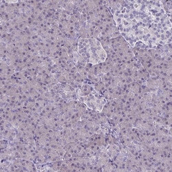 Invitrogen CD38 Polyclonal Antibody 100 &mu;L; Unconjugated:Antibodies,