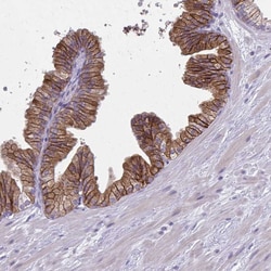 Invitrogen CD38 Polyclonal Antibody 100 &mu;L; Unconjugated:Antibodies,