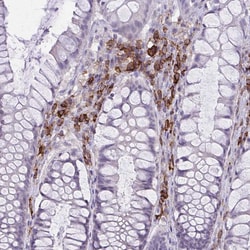Invitrogen CD38 Polyclonal Antibody 100 &mu;L; Unconjugated:Antibodies,