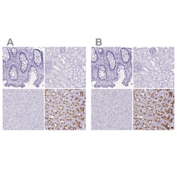 Invitrogen ATP4B Polyclonal Antibody 100 &mu;L; Unconjugated:Antibodies,