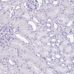 Invitrogen ATP4B Polyclonal Antibody 100 &mu;L; Unconjugated:Antibodies,