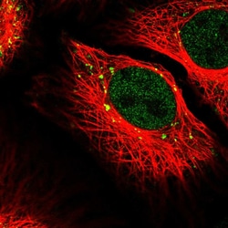 Invitrogen RANBP6 Polyclonal Antibody 100 &mu;L; Unconjugated:Antibodies,