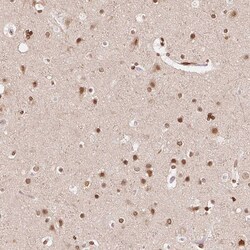 Invitrogen SAP30BP Polyclonal Antibody 100 &mu;L; Unconjugated:Antibodies,