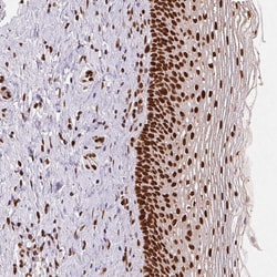 Invitrogen SAP30BP Polyclonal Antibody 100 &mu;L; Unconjugated:Antibodies,