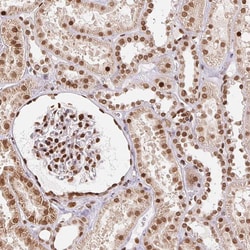 Invitrogen SAP30BP Polyclonal Antibody 100 &mu;L; Unconjugated:Antibodies,