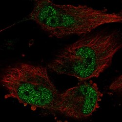 Invitrogen TATDN1 Polyclonal Antibody 100 &mu;L; Unconjugated:Antibodies,