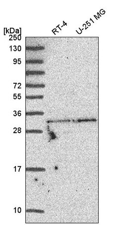 Invitrogen TATDN1 Polyclonal Antibody 100 &mu;L; Unconjugated:Antibodies,