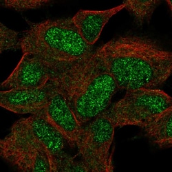 Invitrogen KIAA0408 Polyclonal Antibody 100 μL; Unconjugated:Antibodies,