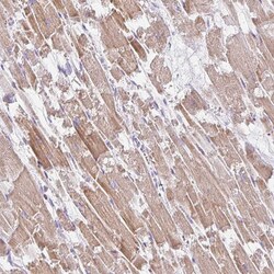 Invitrogen PLA2G5 Polyclonal Antibody 100 &mu;L; Unconjugated:Antibodies,