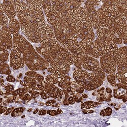 Invitrogen CYP21A2 Polyclonal Antibody 100 &mu;L; Unconjugated:Antibodies,
