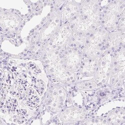 Invitrogen CYP21A2 Polyclonal Antibody 100 &mu;L; Unconjugated:Antibodies,