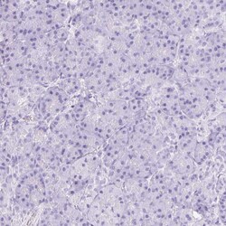 Invitrogen CYP21A2 Polyclonal Antibody 100 &mu;L; Unconjugated:Antibodies,