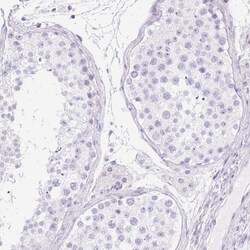 Invitrogen CYP21A2 Polyclonal Antibody 100 &mu;L; Unconjugated:Antibodies,