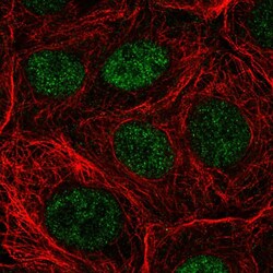 Invitrogen NUDT22 Polyclonal Antibody 100 &mu;L; Unconjugated:Antibodies,