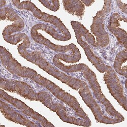 Invitrogen HFE Polyclonal Antibody 100 &mu;L; Unconjugated:Antibodies,
