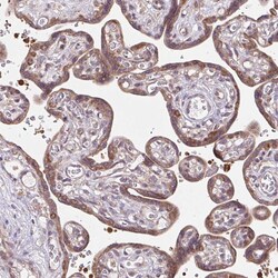 Invitrogen HFE Polyclonal Antibody 100 &mu;L; Unconjugated:Antibodies,