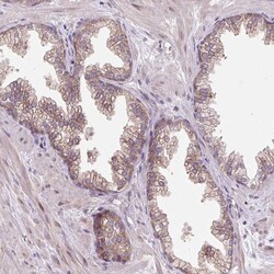 Invitrogen HFE Polyclonal Antibody 100 &mu;L; Unconjugated:Antibodies,