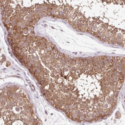 Invitrogen HFE Polyclonal Antibody 100 &mu;L; Unconjugated:Antibodies,
